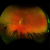 Greg Puciato - Mirrorcell (Cover Artwork)