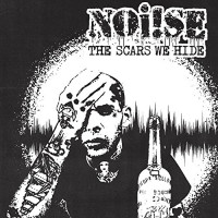 Noi!se - The Scars We Hide