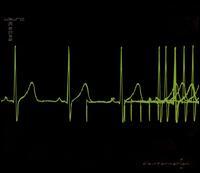 Usurp Synapse - Disinformation Fix (Cover Artwork)